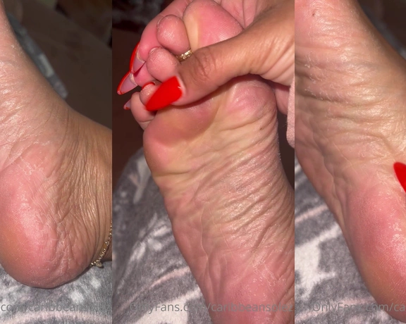 CaribbeanSolez aka caribbeansolez - 12-07-2022 OnlyFans Video - Foot peel update